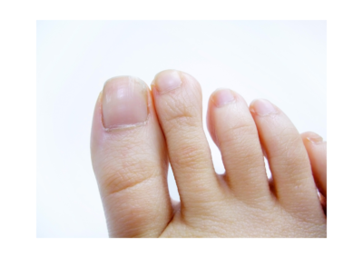 My body - Toes - ESL A1 - Nexgentutorpro