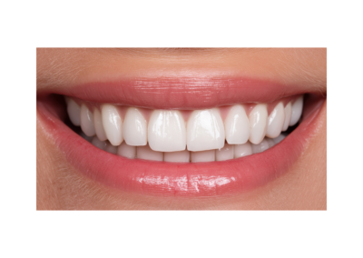 My body - Mouth - ESL A1 - Nexgentutorpro